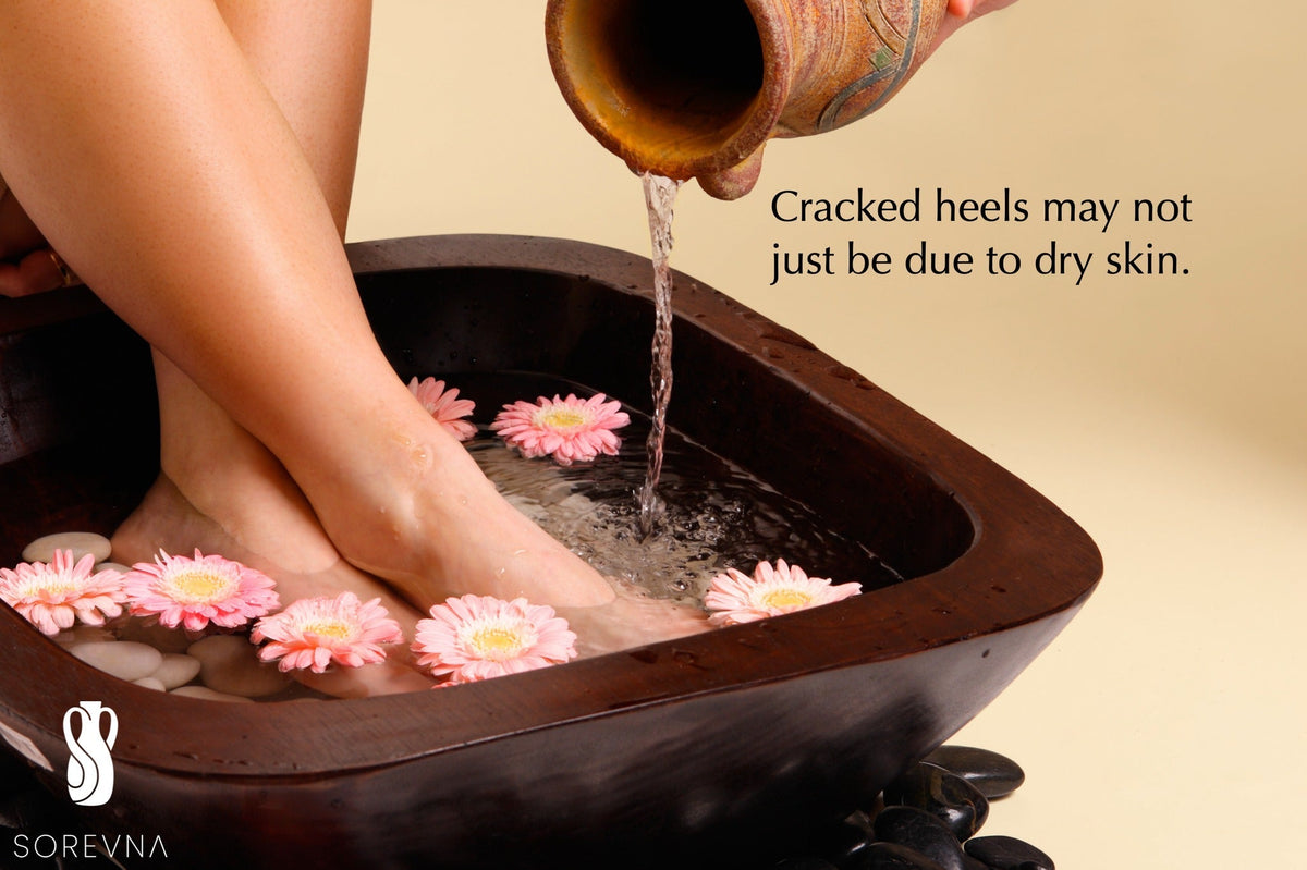 Your Weekend Foot Spa Routine: 3 Steps for Softer, Smoother Feet