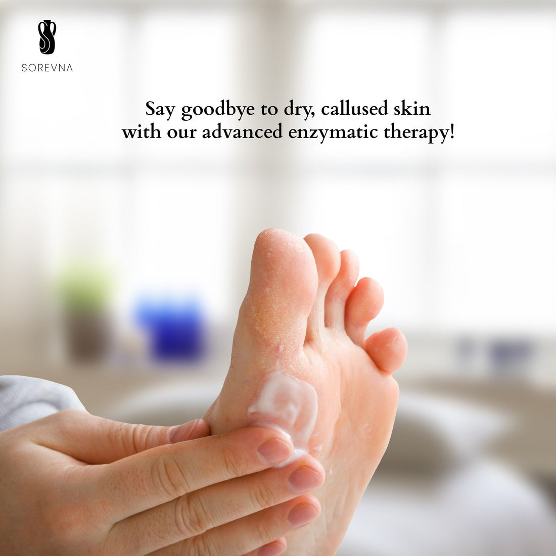 Why Thick, Rough Calluses Are No Match for SOREVNA Foot Creams