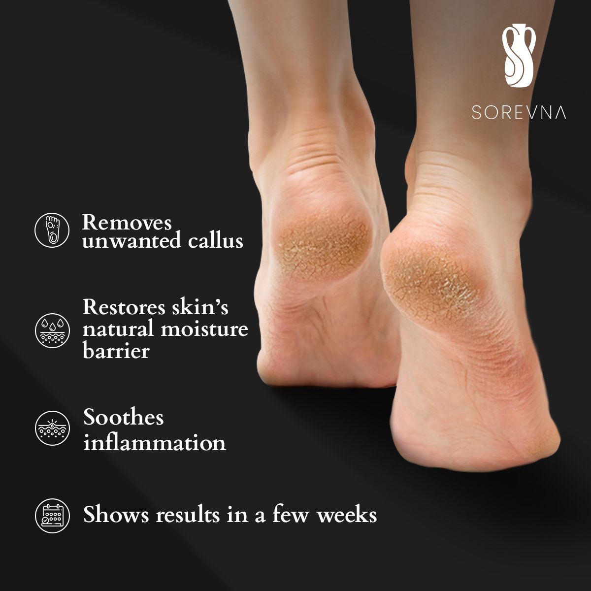 Close-up of cracked heels showing callused feet with benefits of the cream that removes callus & restores moisture.
